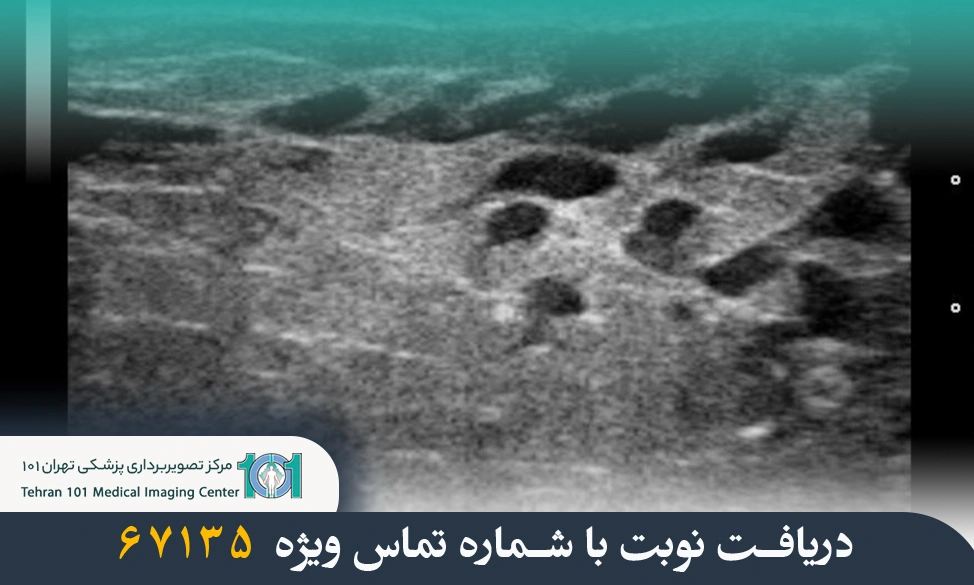 بهترین زمان برای انجام سونوگرافی سینه چه موقع است؟ راهنمای کامل 3 بهترین زمان برای انجام سونوگرافی سینه