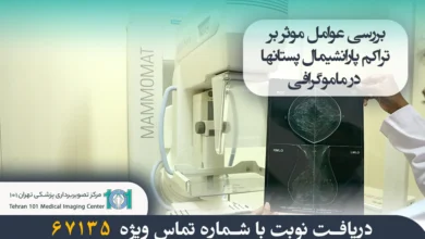 بررسی عوامل موثر بر تراکم پارانشیمال پستان ها در ماموگرافی