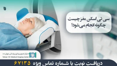 سی تی اسکن مغز چیست؟ و چگونه انجام می‌شود؟ | مرکز تصویربرداری پزشکی تهران 101