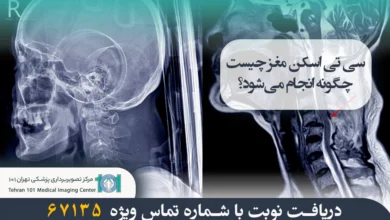سی تی اسکن گردن چیست؟ بررسی کامل کاربردها، دلایل انجام و مراحل آن 28 سی تی اسکن گردن چیست؟