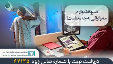 فیبروگلاندولار در ماموگرافی چیست و چه عواملی بر تراکم آن تاثیر میگذارند؟ 4 فیبروگلاندولار در ماموگرافی به چه معناست؟