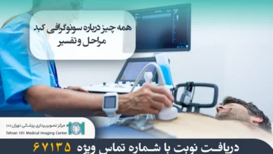 سونوگرافی کبد چیست؟ مراحل، تفسیر و نکات مهم 8 سونوگرافی کبد چیست؟