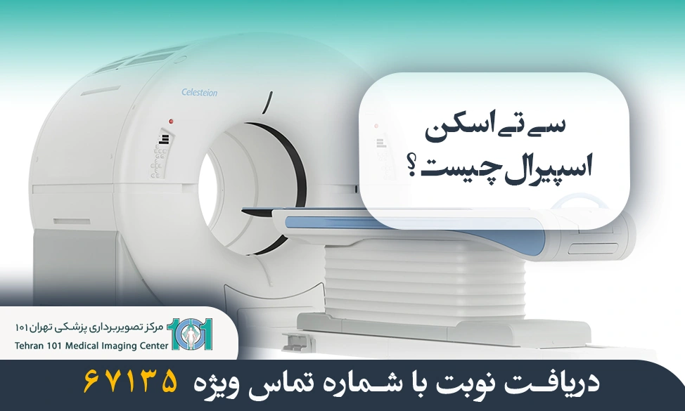 انواع روش سی تی اسکن اسپیرال