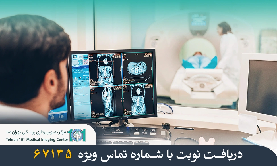 تفاوت رادیولوژی و سی تی اسکن چیست؟ بررسی تخصصی تفاوتها و کاربردها 3 تفاوت رادیولوژی و سی تی اسکن