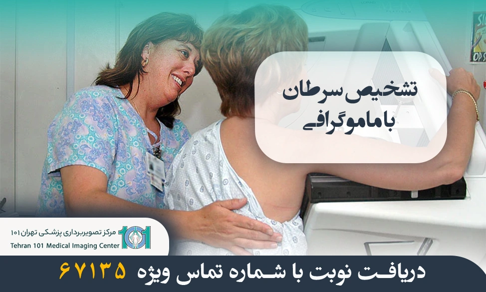 تشخیص زودهنگام سرطان پستان با ماموگرافی 4 ماموگرافی سینه