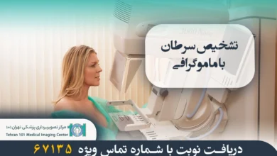 تشخیص زودهنگام سرطان پستان با ماموگرافی 2 تشخیص سرطان با ماموگرافی