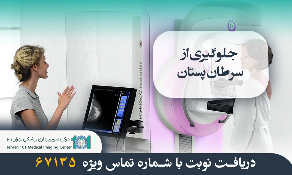 چگونه از سرطان پستان پیشگیری کنیم؟ راهکارهای علمی و موثر 3 جلوگیری از سرطان پستان