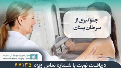 چگونه از سرطان پستان پیشگیری کنیم؟ راهکارهای علمی و موثر 2 جلوگیری از سرطان پستان