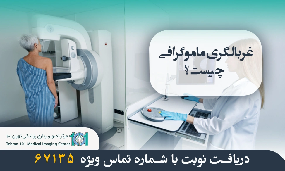 غربالگری ماموگرافی چیست
