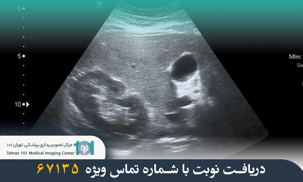 اکوژن در سونوگرافی چیست؟