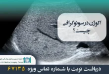 اکوژن در سونوگرافی چیست؟