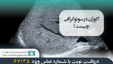 اکوژن در سونوگرافی چیست و توده اکوژن چه مفهومی دارد؟ 35 اکوژن در سونوگرافی چیست؟