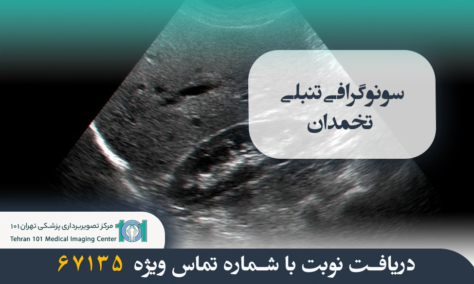 سونوگرافی تنبلی تخمدان