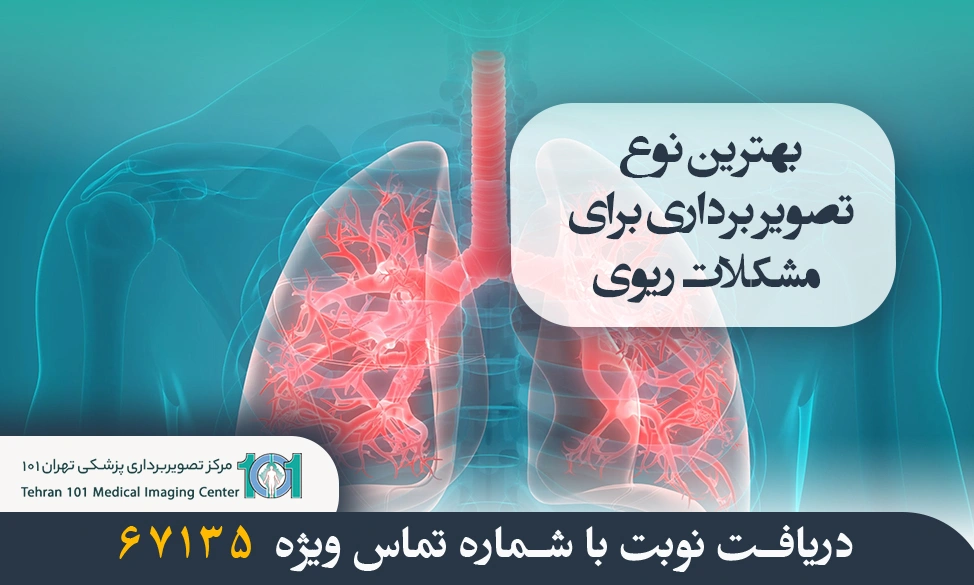 بهترین نوع تصویر برداری برای مشکلات ریوی